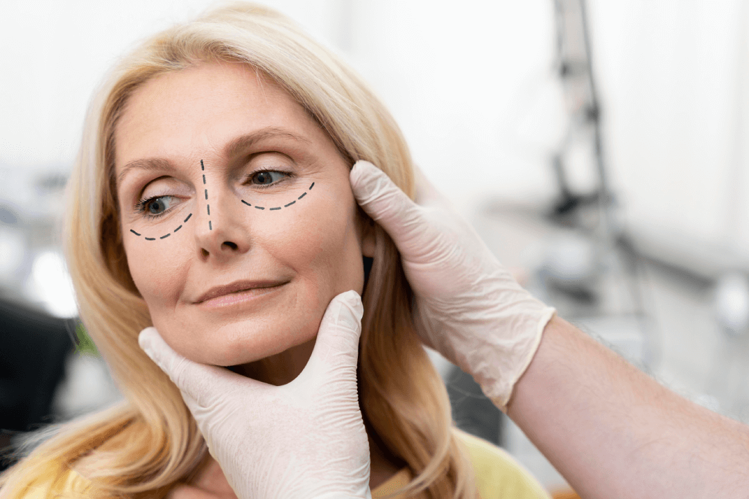 Eye Lid Surgery