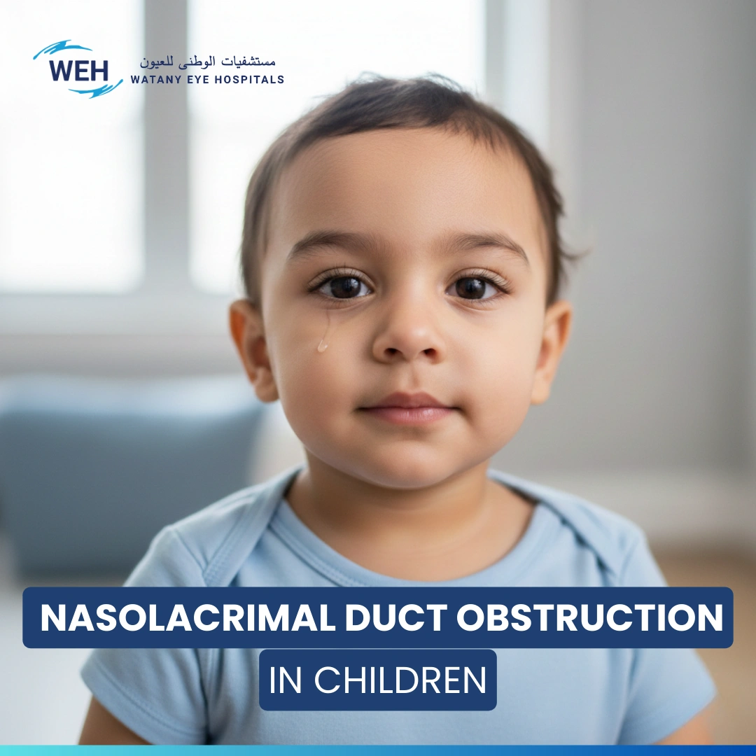Nasolacrimal Duct Obstruction in Children