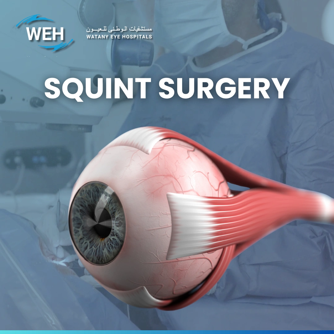 Strabismus Surgery